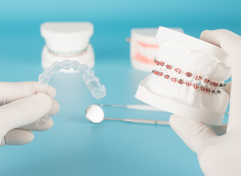 矯正歯科・小児矯正歯科